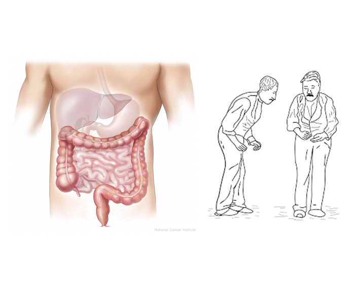 PARKINSON E INTESTINO: IL LEGAME CHE (NON) TI ASPETTI